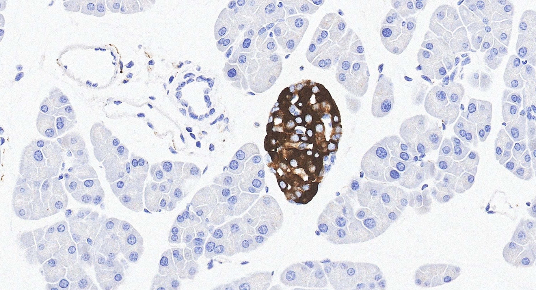 IHC staining of mouse pancreas using 10954-1-AP IHC staining of mouse pancreas using 10954-1-AP