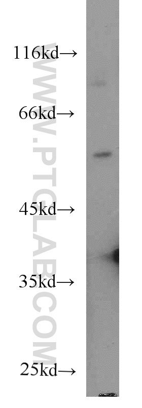 WB analysis of human heart using 66029-1-Ig