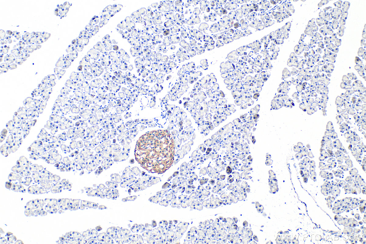 IHC staining of mouse pancreas using 10761-1-AP