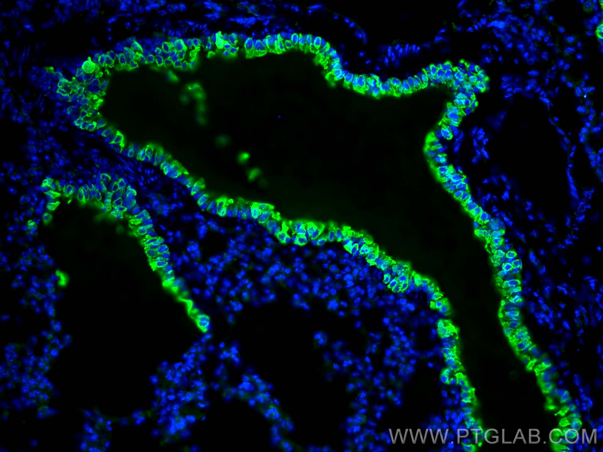 IF Staining of mouse lung using 10490-1-AP