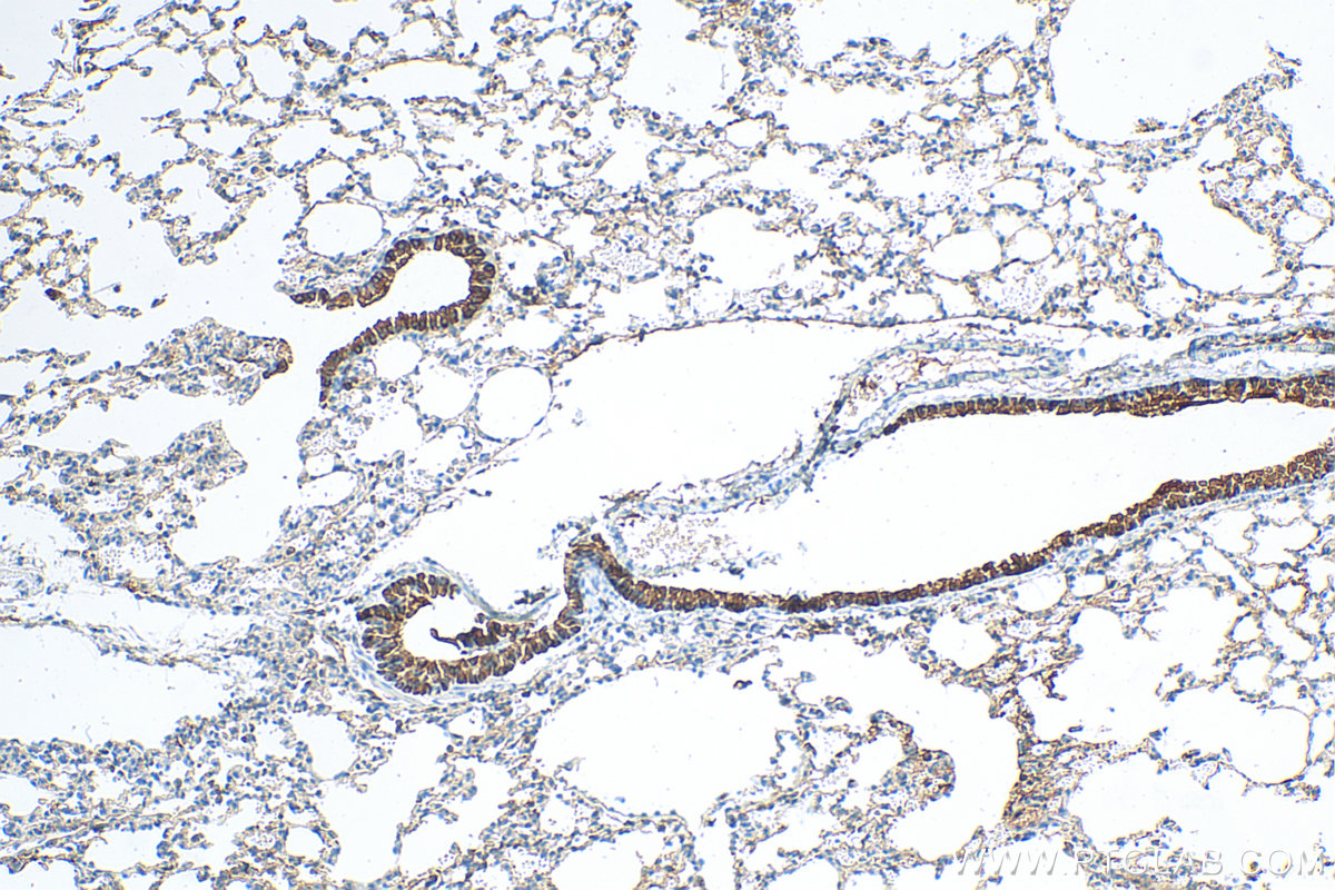 IHC staining of mouse lung using 10490-1-AP