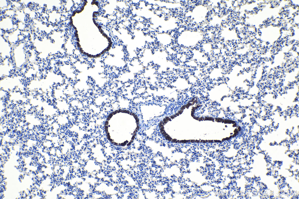 IHC staining of mouse lung using 10490-1-AP