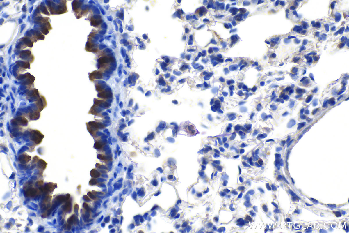 IHC staining of rat lung using 10490-1-AP