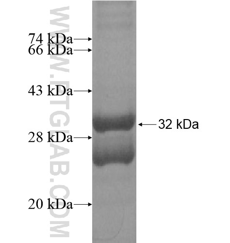 SCGB1D1 fusion protein Ag15608 SDS-PAGE SCGB1D1 fusion protein Ag15608 SDS-PAGE