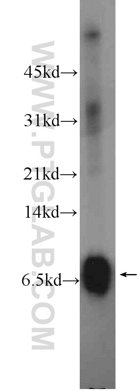 Mammaglobin A Polyclonal antibody