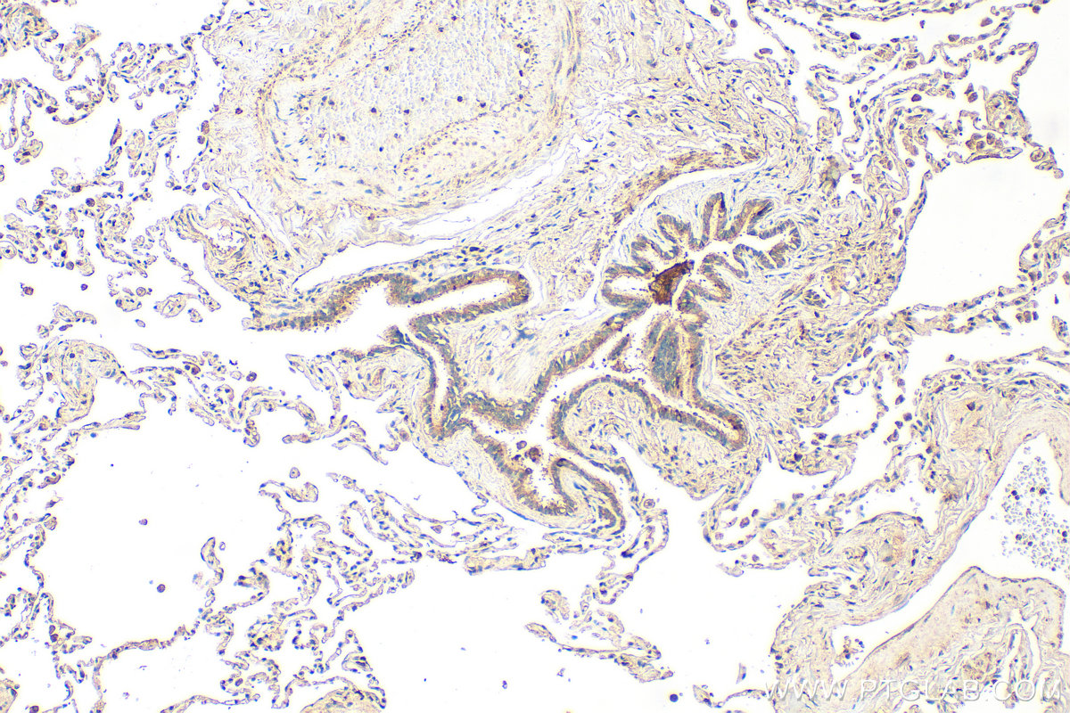 IHC staining of human lung using 34191-1-AP IHC staining of human lung using 34191-1-AP