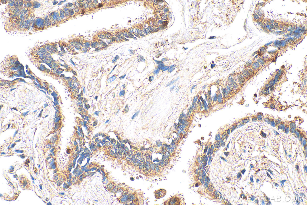 IHC staining of human lung using 34191-1-AP IHC staining of human lung using 34191-1-AP