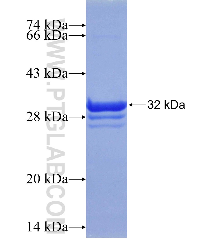 SCGB3A2 fusion protein Ag23969 SDS-PAGE