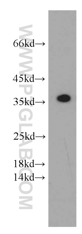 WB analysis of human skeletal muscle using 55019-1-AP