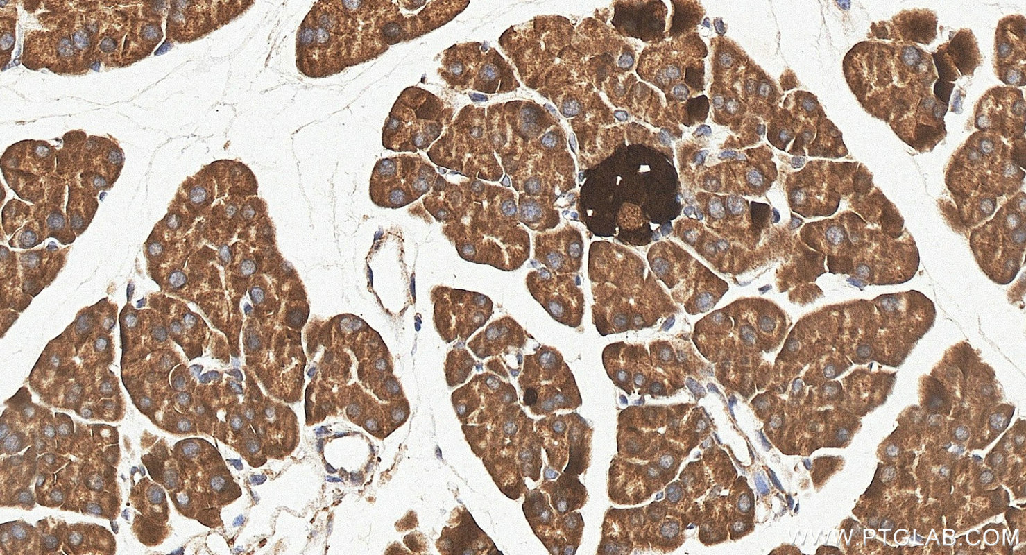 IHC staining of mouse pancreas using 14919-1-AP IHC staining of mouse pancreas using 14919-1-AP