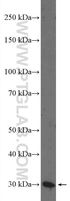 WB analysis of mouse pancreas using 14919-1-AP