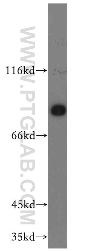 WB analysis of human placenta using 11579-1-AP