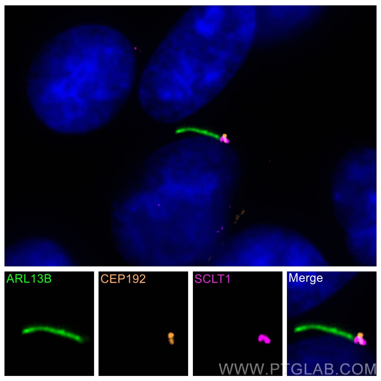 IF Staining of hTERT-RPE1 using 14875-1-AP