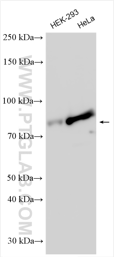 WB analysis using 14875-1-AP