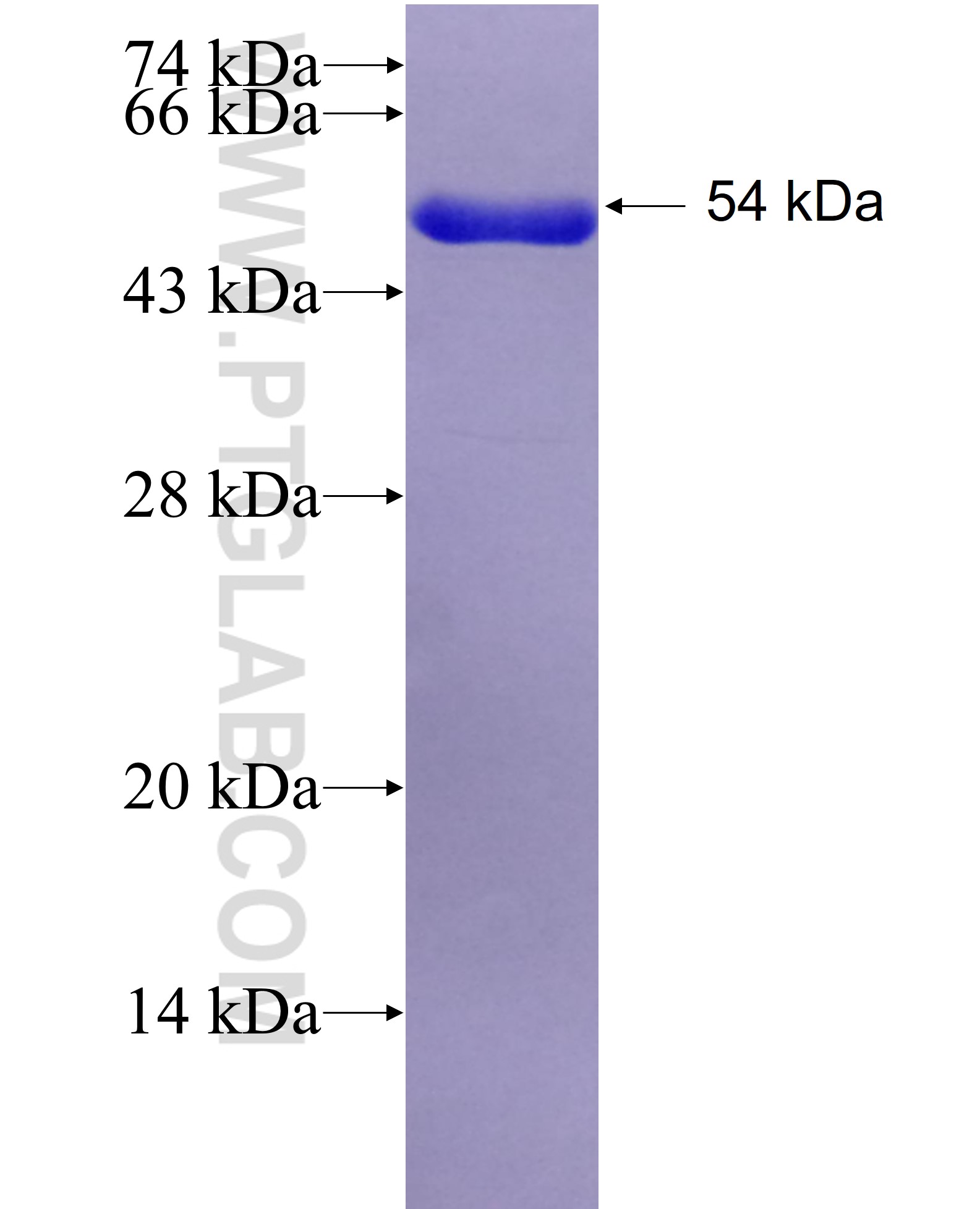 SCLY fusion protein Ag28822 SDS-PAGE SCLY fusion protein Ag28822 SDS-PAGE