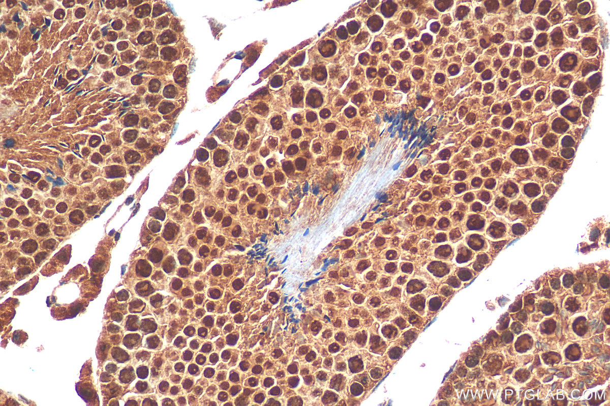 IHC staining of mouse testis using 15093-1-AP