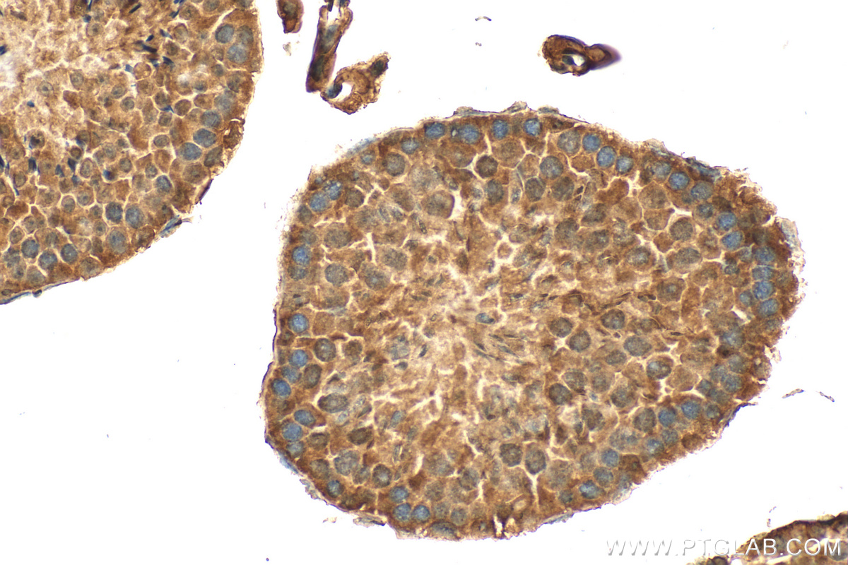 IHC staining of mouse testis using 25439-1-AP