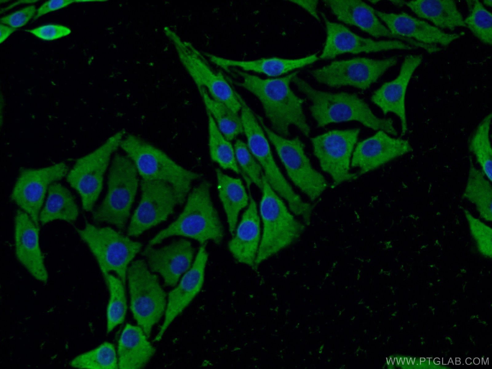 IF Staining of SH-SY5Y using 55334-1-AP