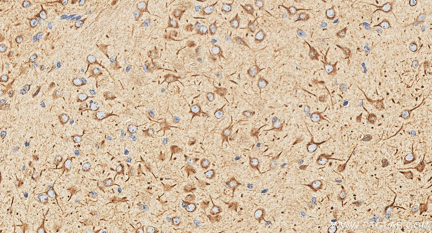 IHC staining of mouse brain using 55334-1-AP IHC staining of mouse brain using 55334-1-AP