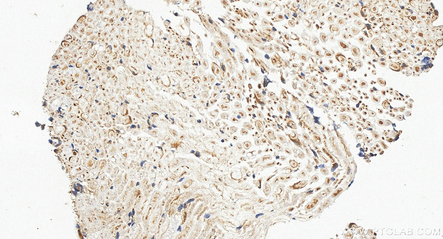 IHC staining of rat dorsal root ganglion using 55334-1-AP IHC staining of rat dorsal root ganglion using 55334-1-AP