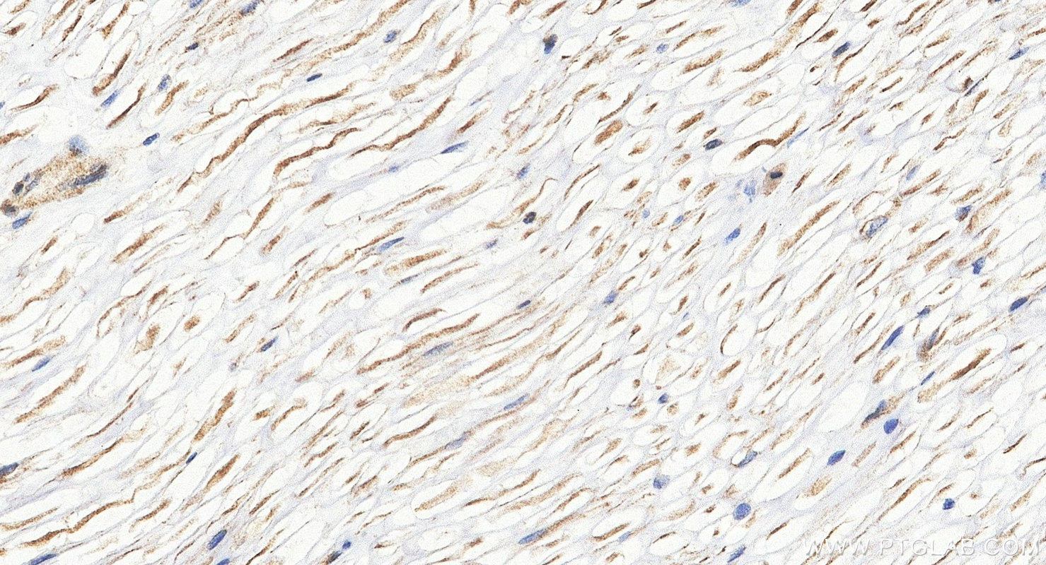 IHC staining of rat Ischiadic nerve using 55334-1-AP (same clone as 55334-1-PBS) IHC staining of rat Ischiadic nerve using 55334-1-AP (same clone as 55334-1-PBS)