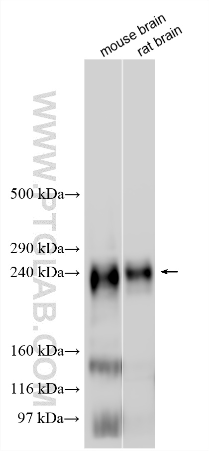 Various lysates were subjected to SDS PAGE followed by western blot with 28079-1-AP (SCN1A antibody) at dilution of 1:2000 incubated at room temperature for 1.5 hours. WB analysis using 28079-1-AP