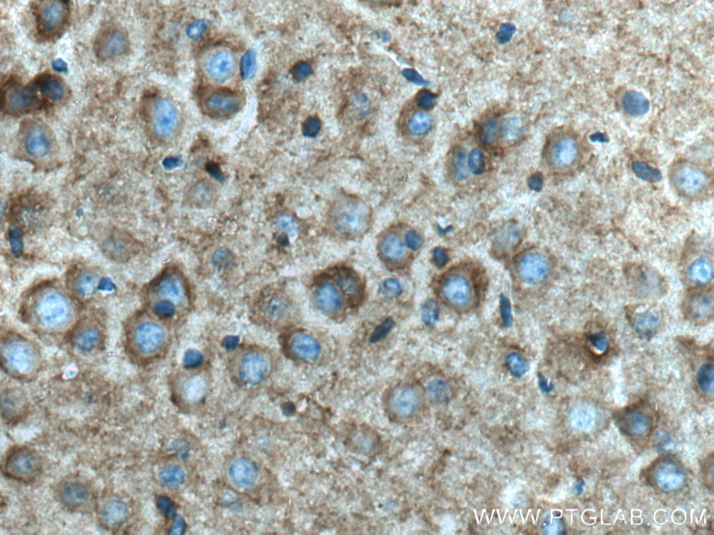 SCN1B