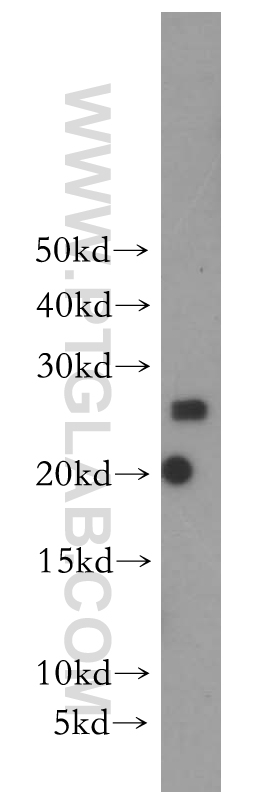 SCN2B Polyclonal antibody