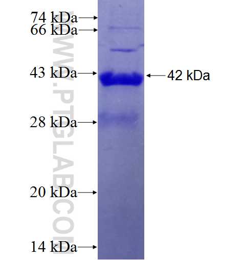 SCN2B fusion protein Ag4515 SDS-PAGE