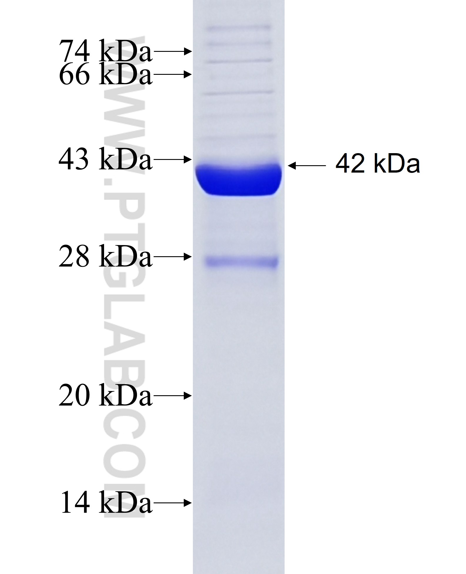 SCN2B fusion protein Ag4515 SDS-PAGE