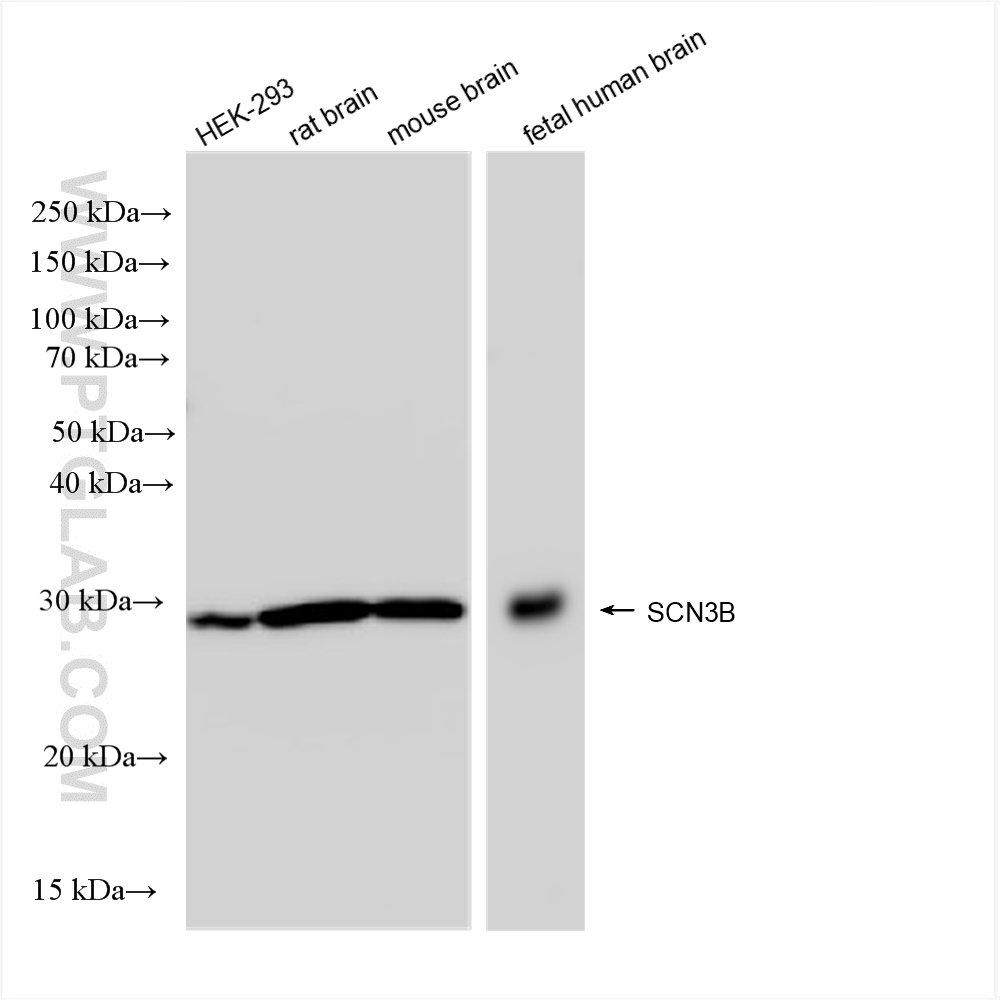 WB analysis using 82959-7-RR