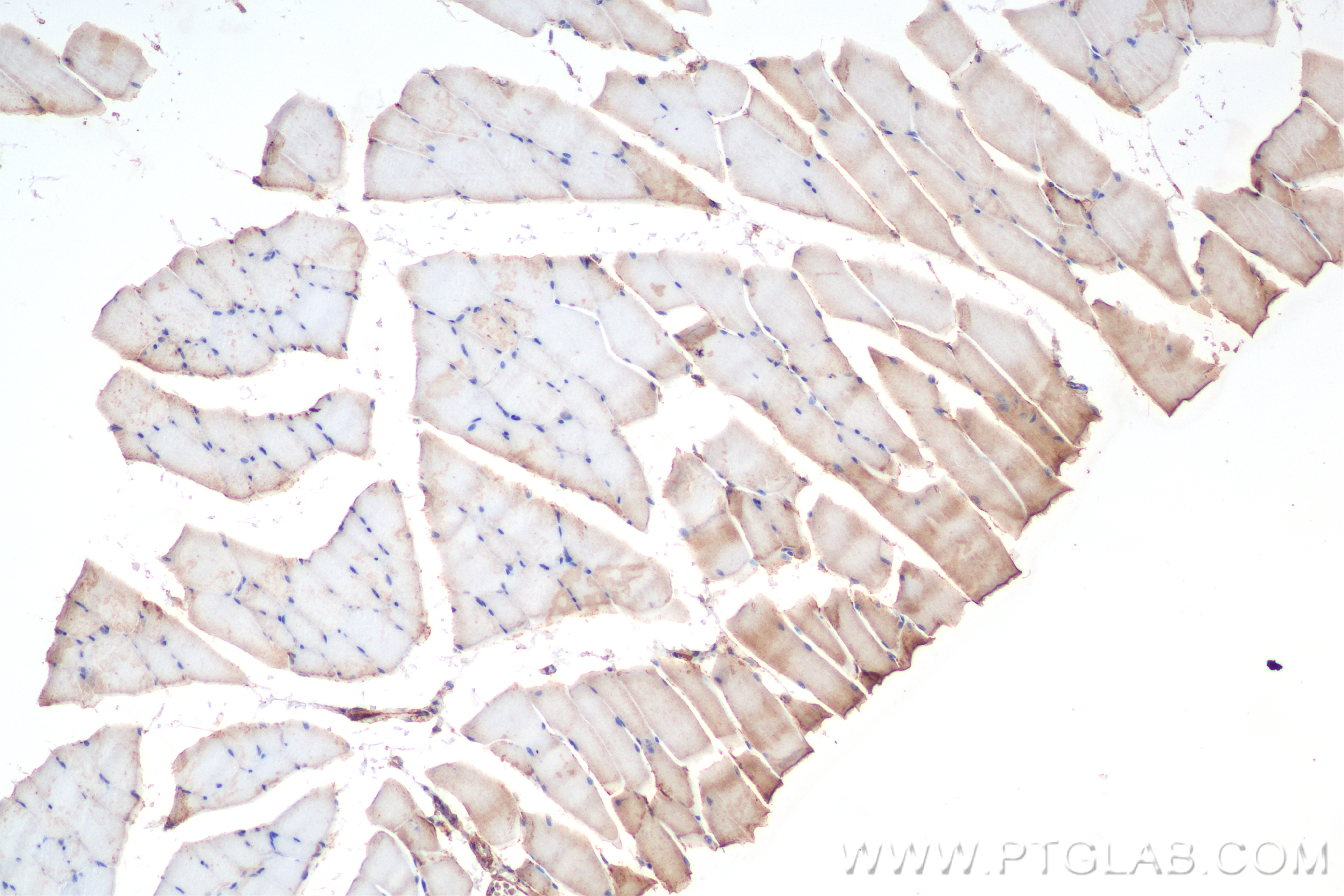 IHC staining of mouse skeletal muscle using 85698-1-RR