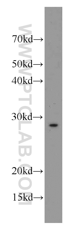 WB analysis of mouse heart using 55438-1-AP