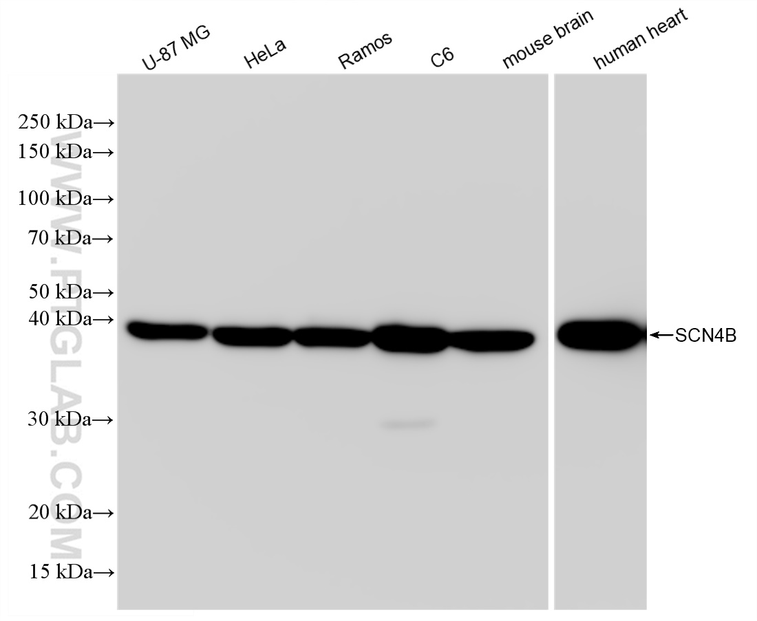 WB analysis using 83027-4-RR (same clone as 83027-4-PBS)