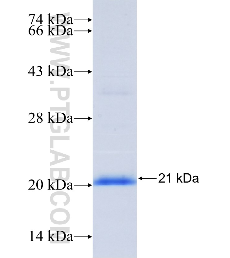 SCN4B fusion protein Ag34101 SDS-PAGE SCN4B fusion protein Ag34101 SDS-PAGE
