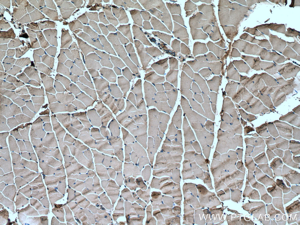 IHC staining of mouse skeletal muscle using 23016-1-AP