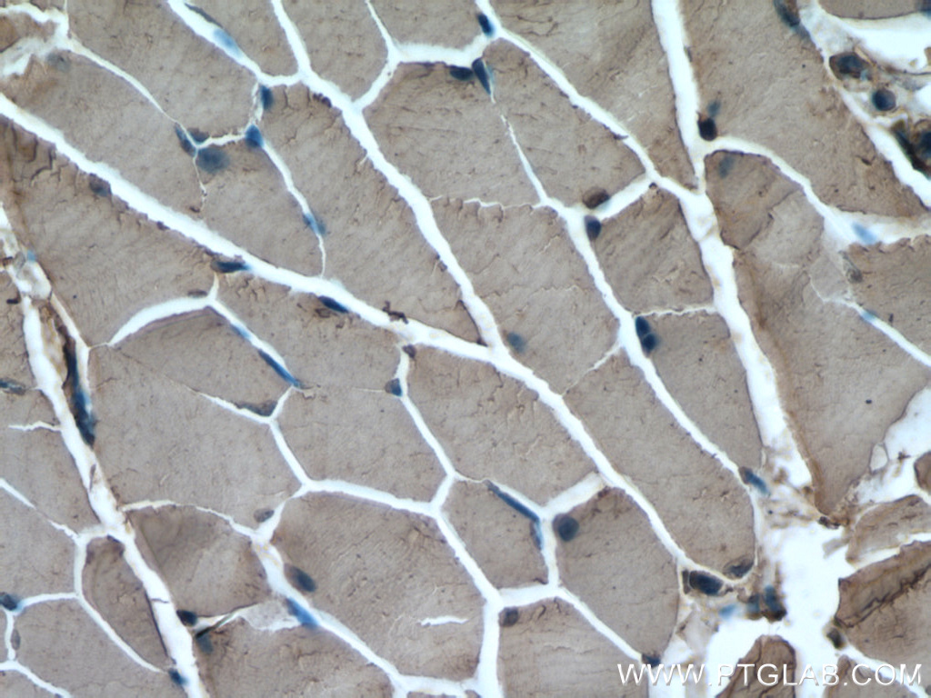 IHC staining of mouse skeletal muscle using 23016-1-AP