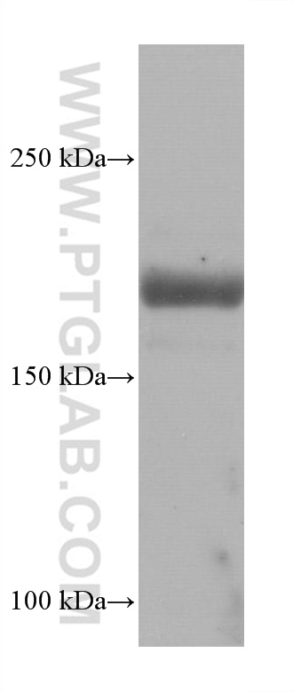 WB analysis of rat heart using 68273-1-Ig