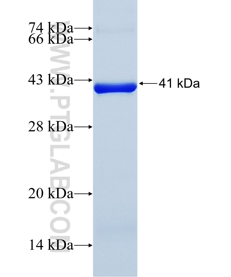 SCN5A fusion protein Ag19275 SDS-PAGE