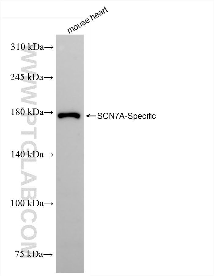 WB analysis of mouse heart using 85797-1-RR