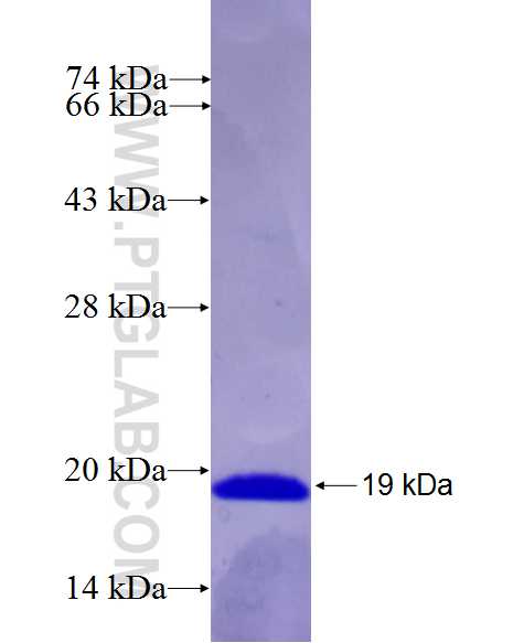 SCN8A fusion protein Ag27008 SDS-PAGE SCN8A fusion protein Ag27008 SDS-PAGE