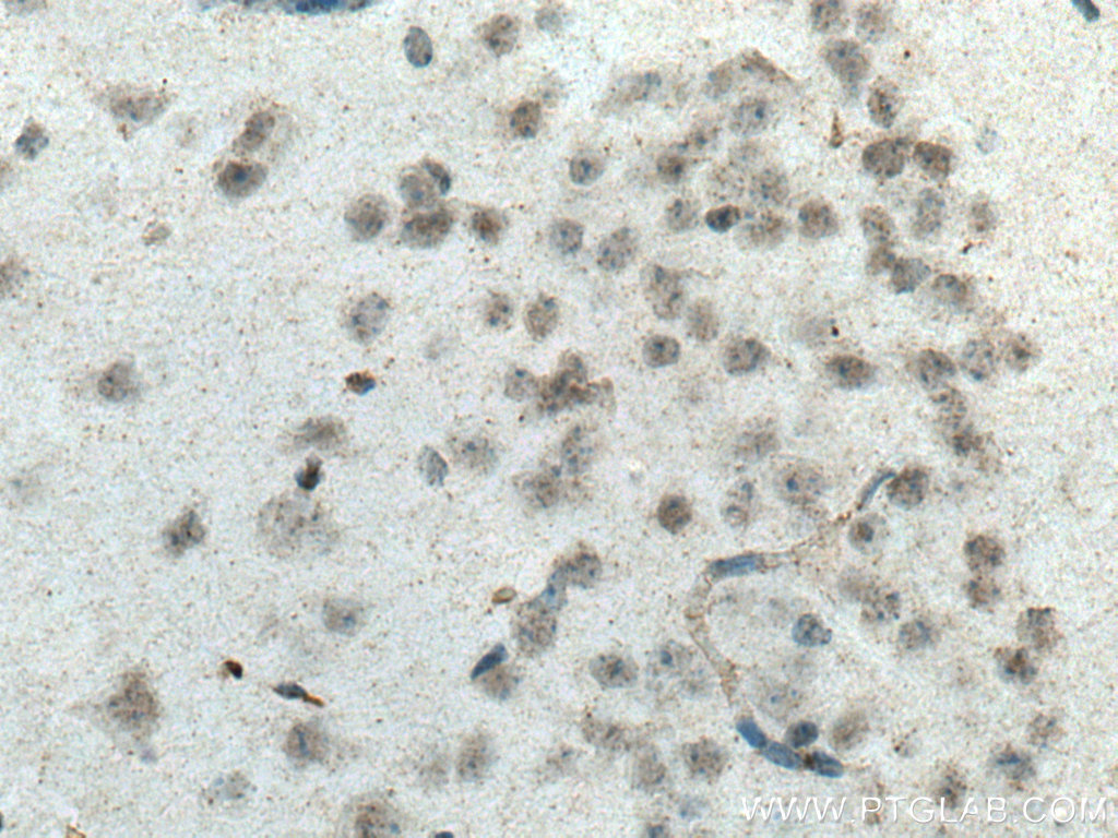 IHC staining of mouse brain using 15490-1-AP
