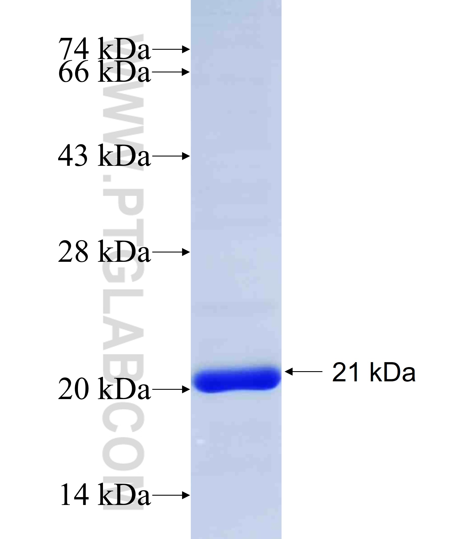 SCNN1A fusion protein Ag30065 SDS-PAGE SCNN1A fusion protein Ag30065 SDS-PAGE