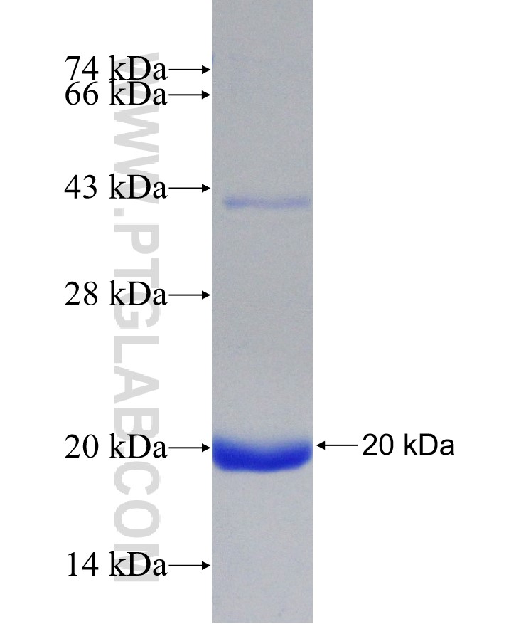 SCNN1A fusion protein Ag31577 SDS-PAGE