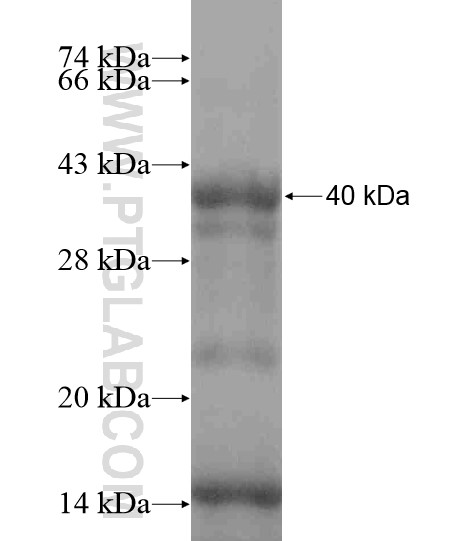 SCNN1D fusion protein Ag18671 SDS-PAGE SCNN1D fusion protein Ag18671 SDS-PAGE