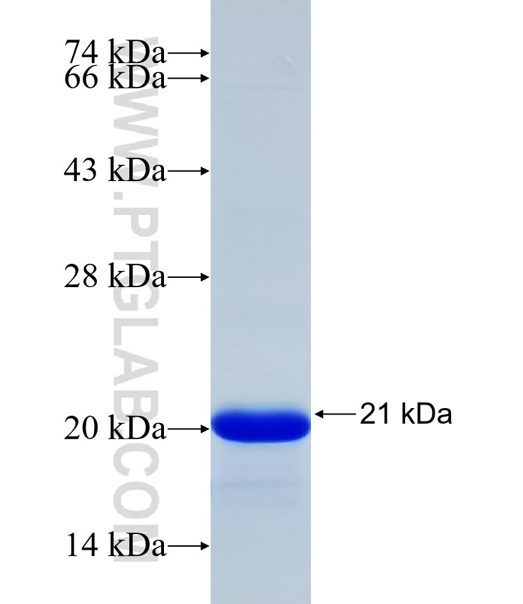 SCNN1G fusion protein Ag32182 SDS-PAGE
