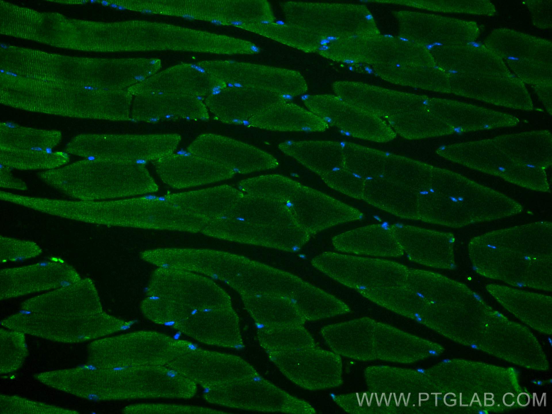 IF Staining of mouse skeletal muscle using 21223-1-AP