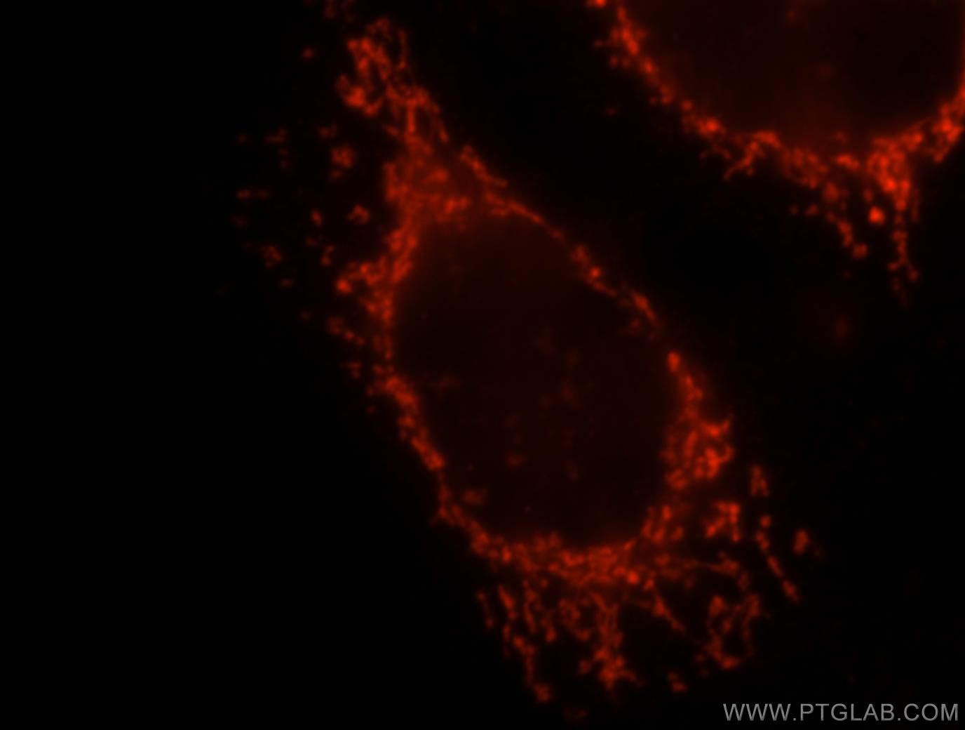 OXCT1 Polyclonal antibody