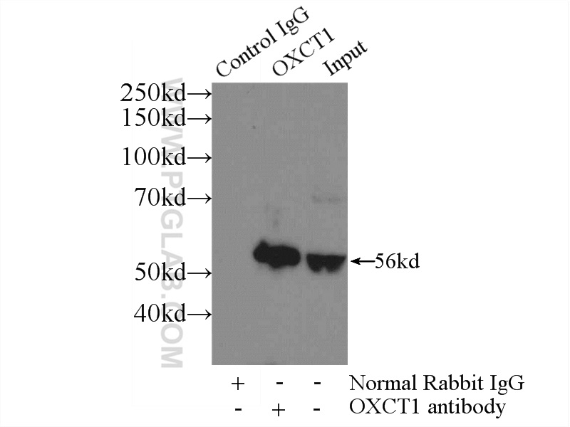 IP experiment of mouse brain using 12175-1-AP