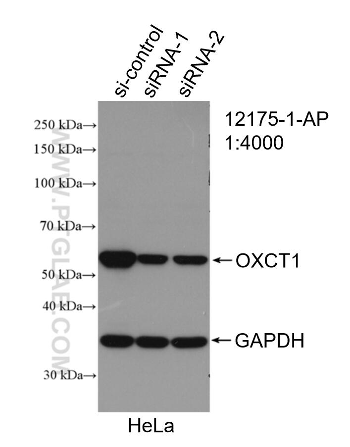 WB analysis of HeLa using 12175-1-AP